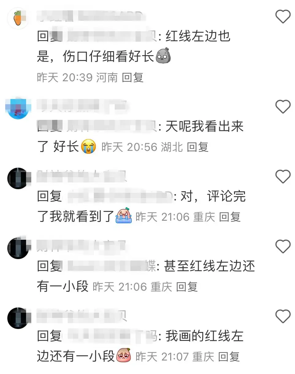 _下巴伤疤图片_下巴受伤留下疤痕算伤残吗